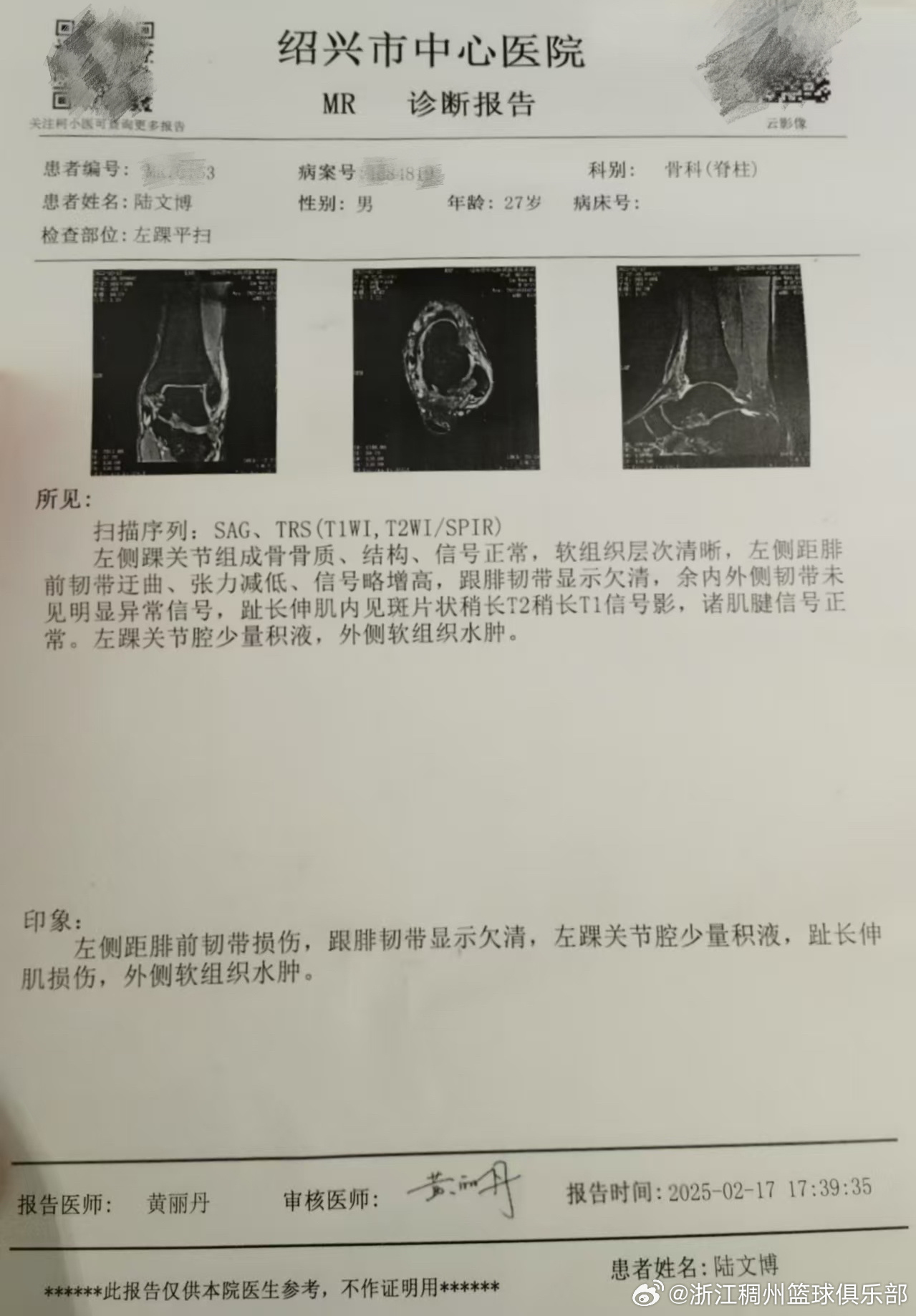 略感遗憾的 略感遗憾的